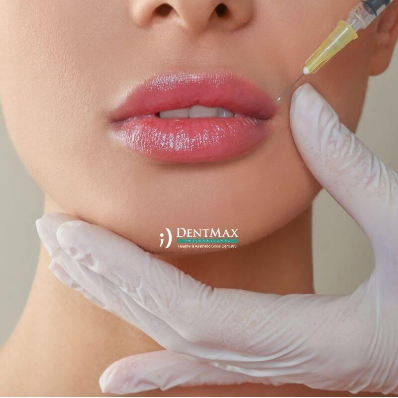 Dentmax