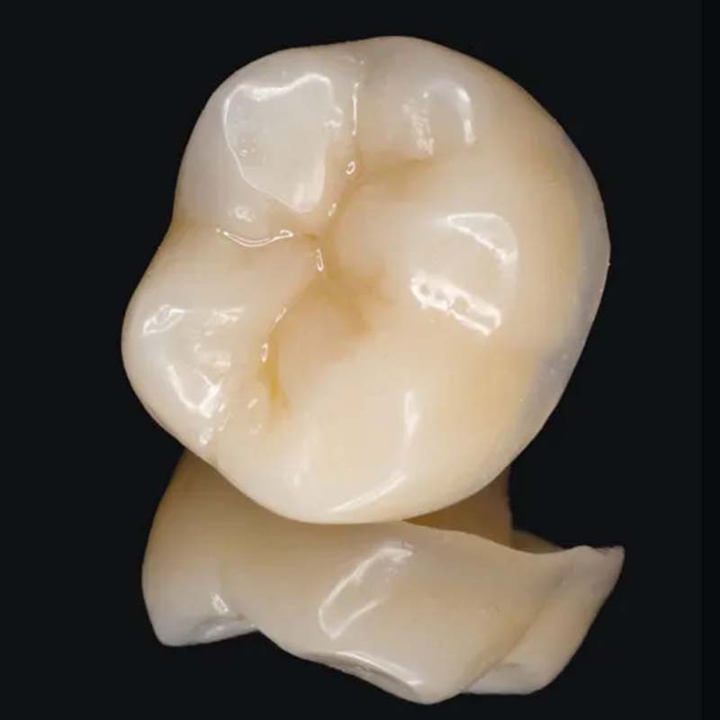 Dentmax