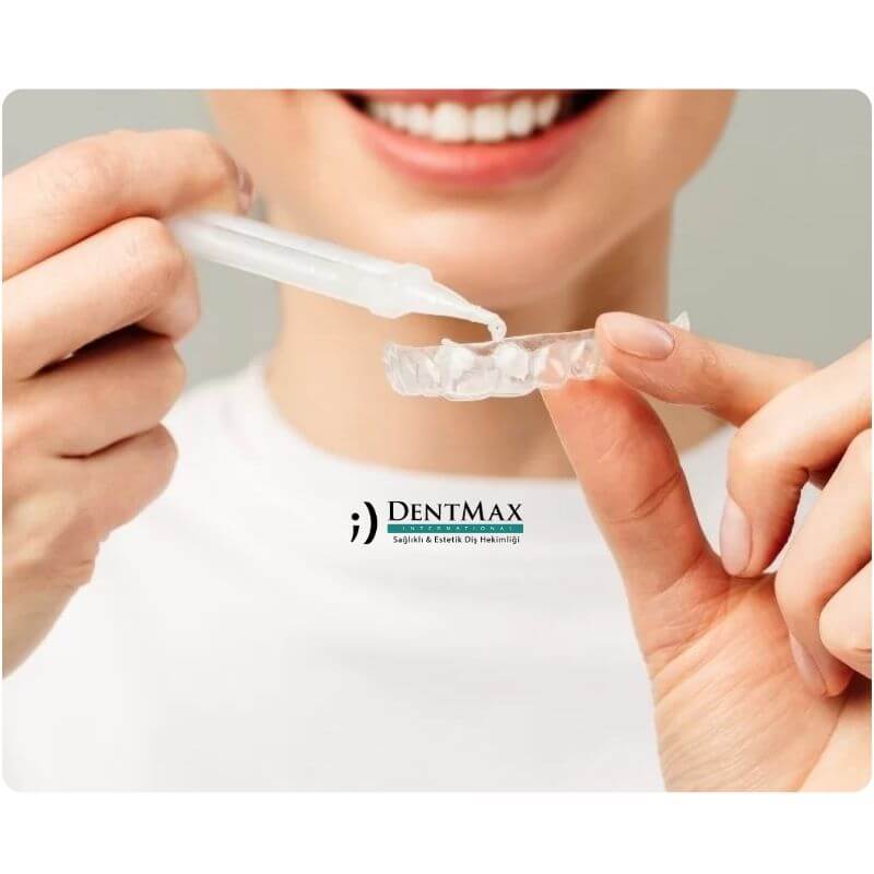 Dentmax