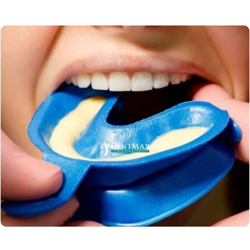 Dentmax