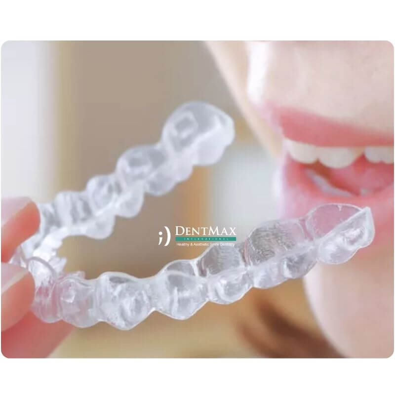 Dentmax