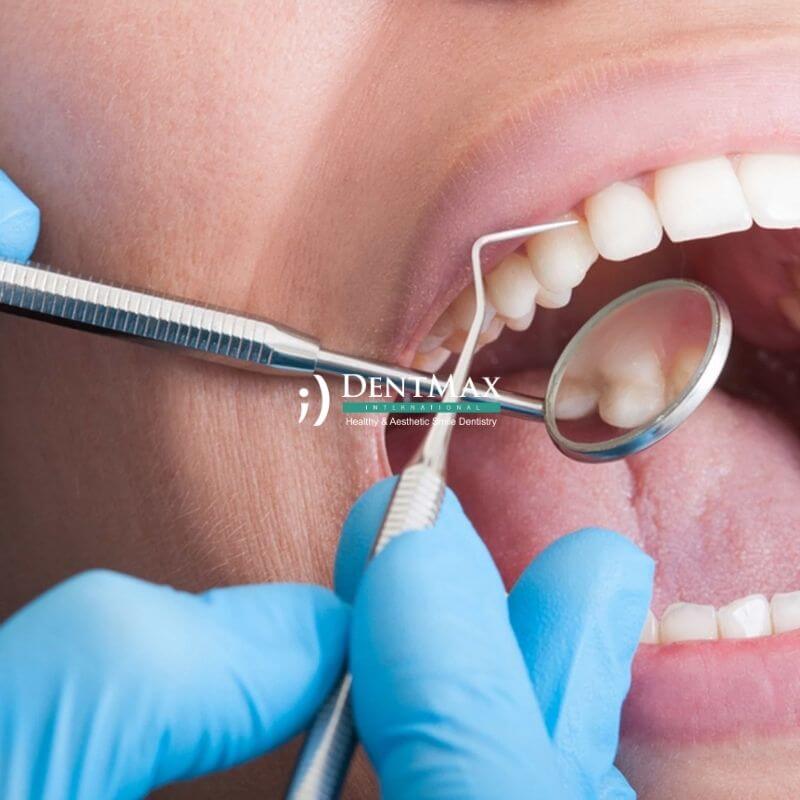 Dentmax