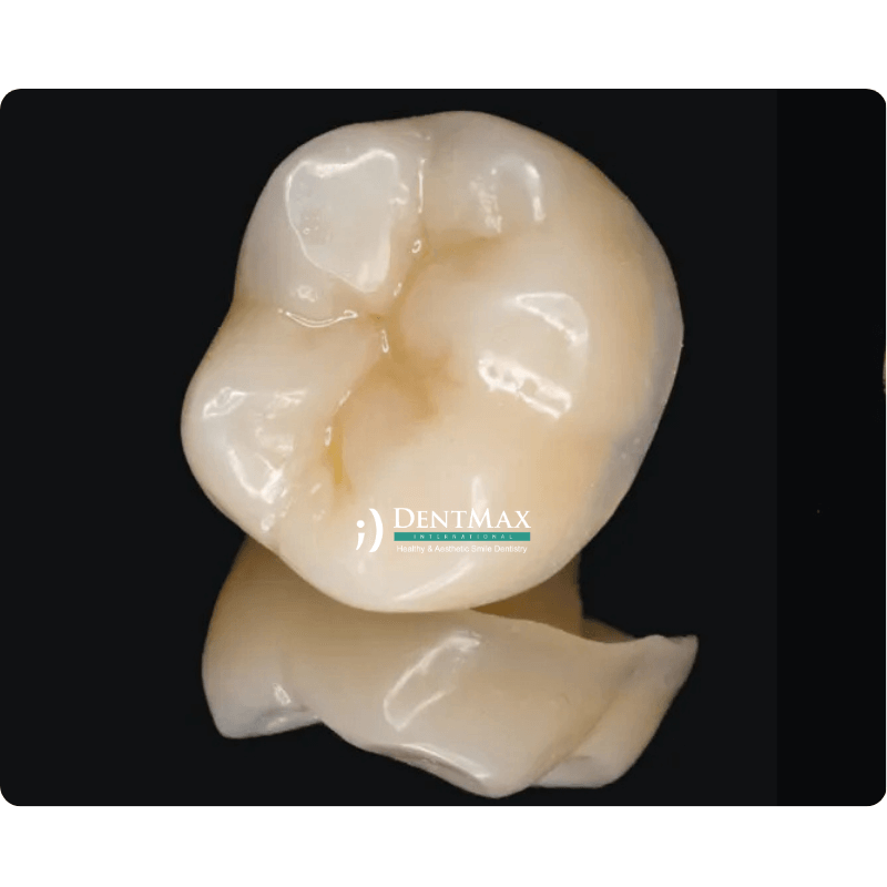 Dentmax