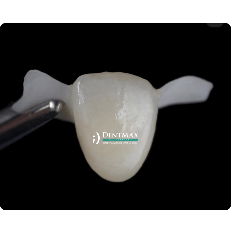 Dentmax