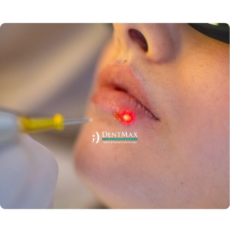 Dentmax