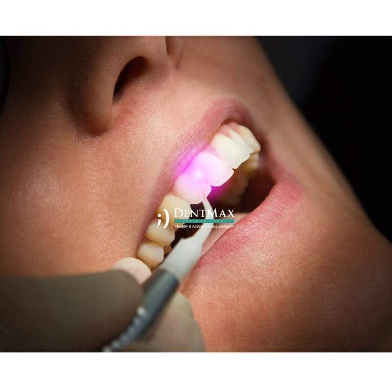 Dentmax