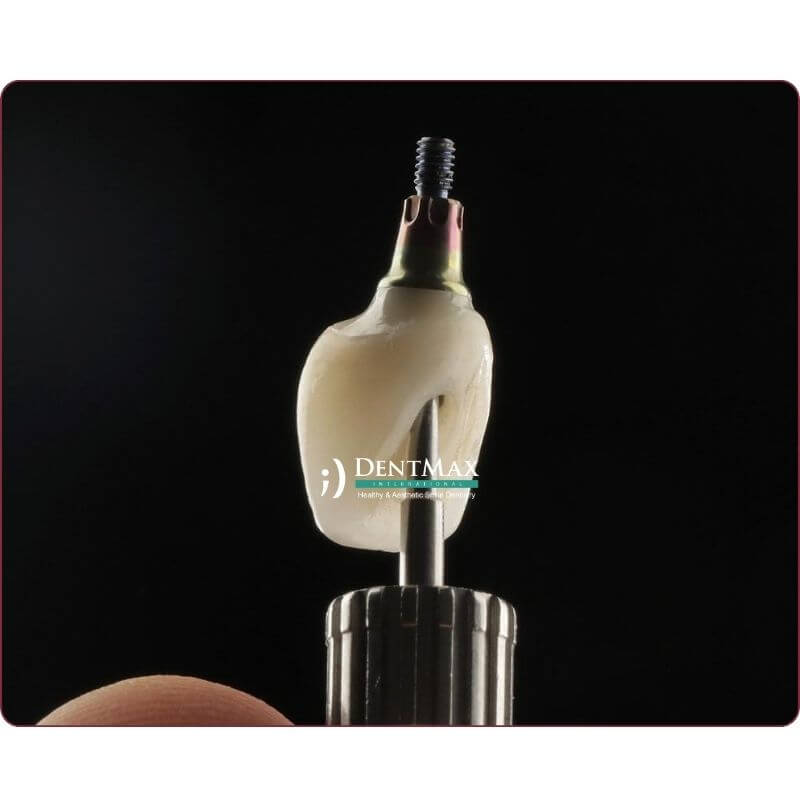 Dentmax
