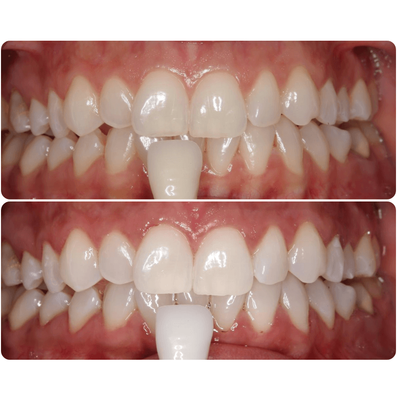 Dentmax