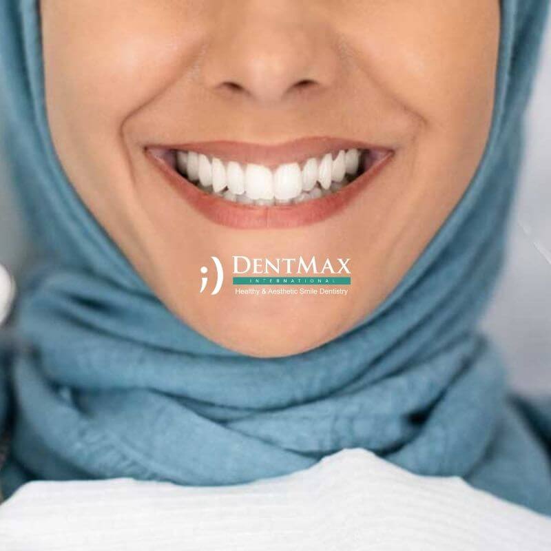 Dentmax