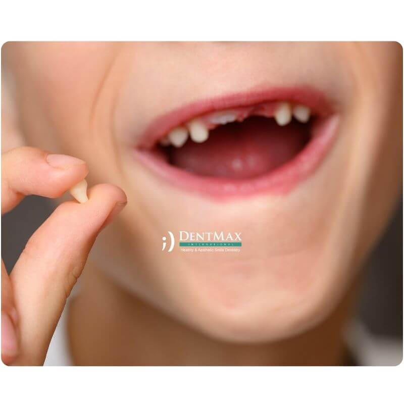 Dentmax