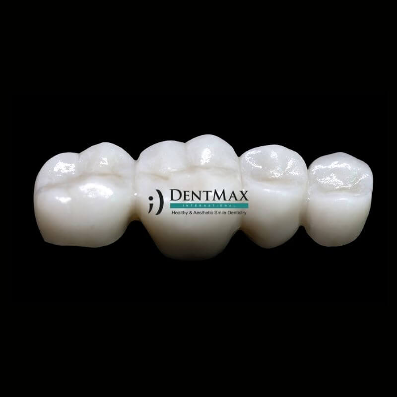 Dentmax