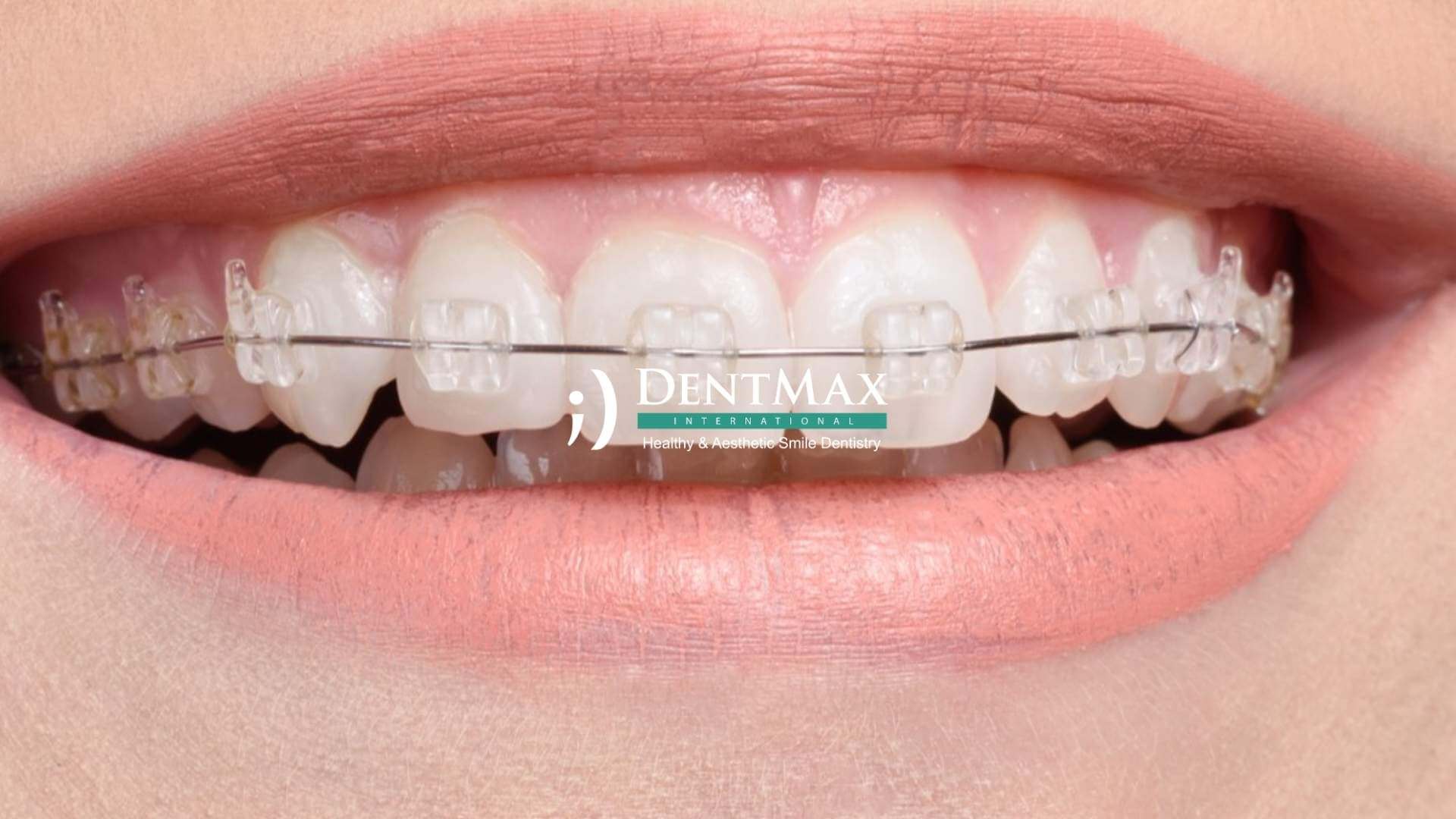 Dentmax Basından