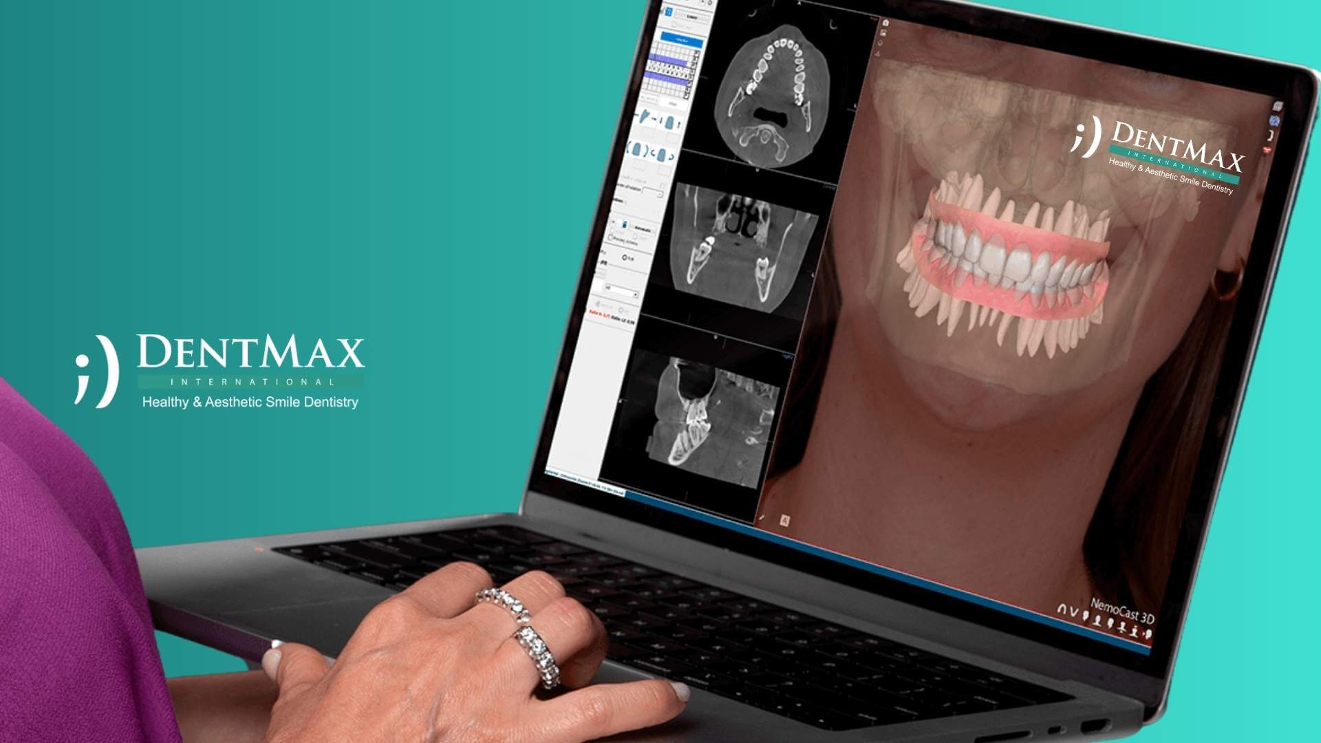 Dentmax Basından