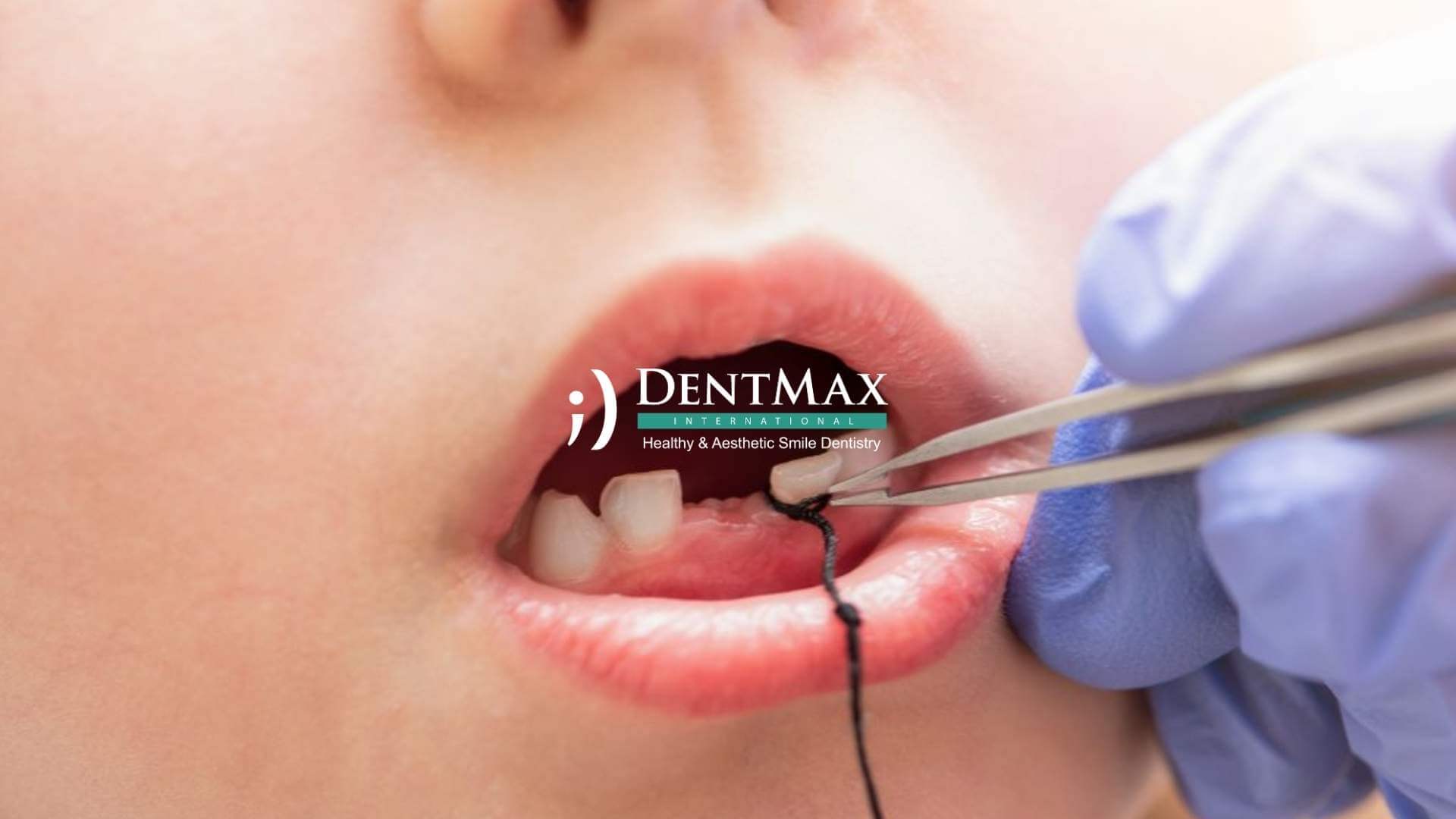 Dentmax Basından