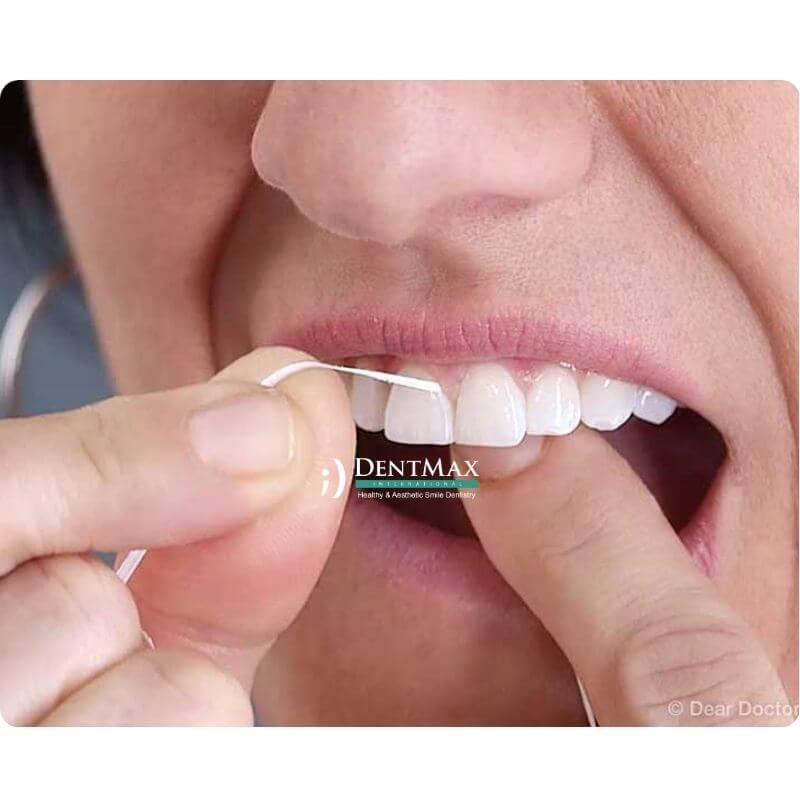 Dentmax