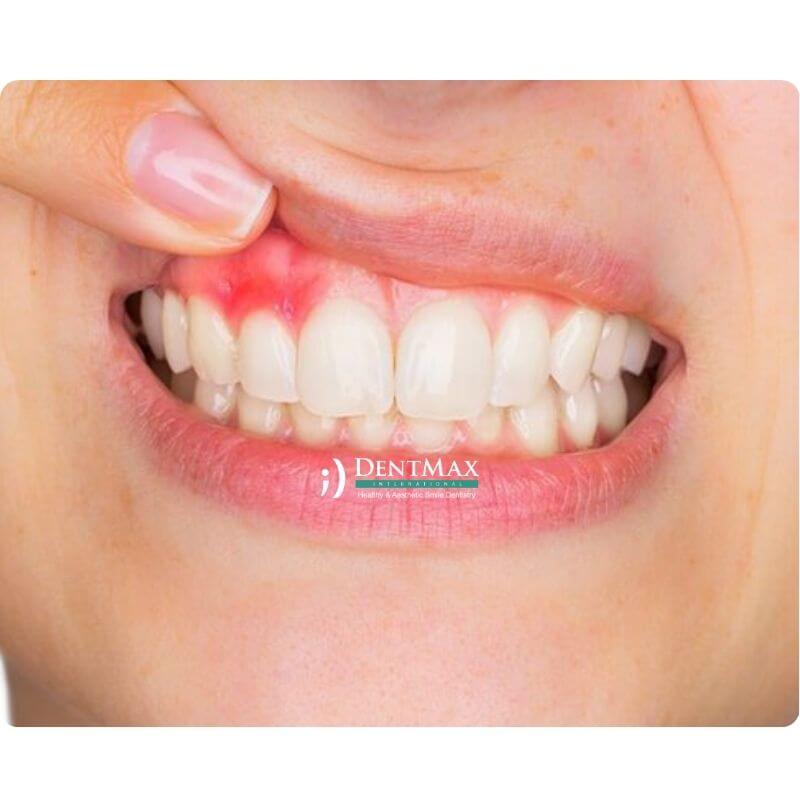 Dentmax Öne Çıkanlar