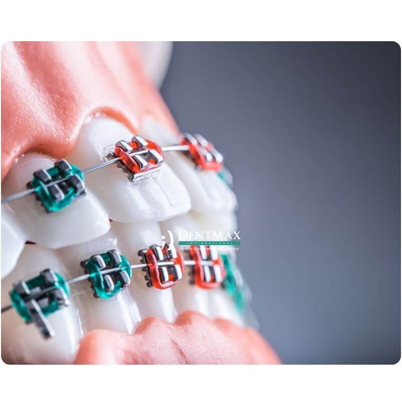 Dentmax Öne Çıkanlar