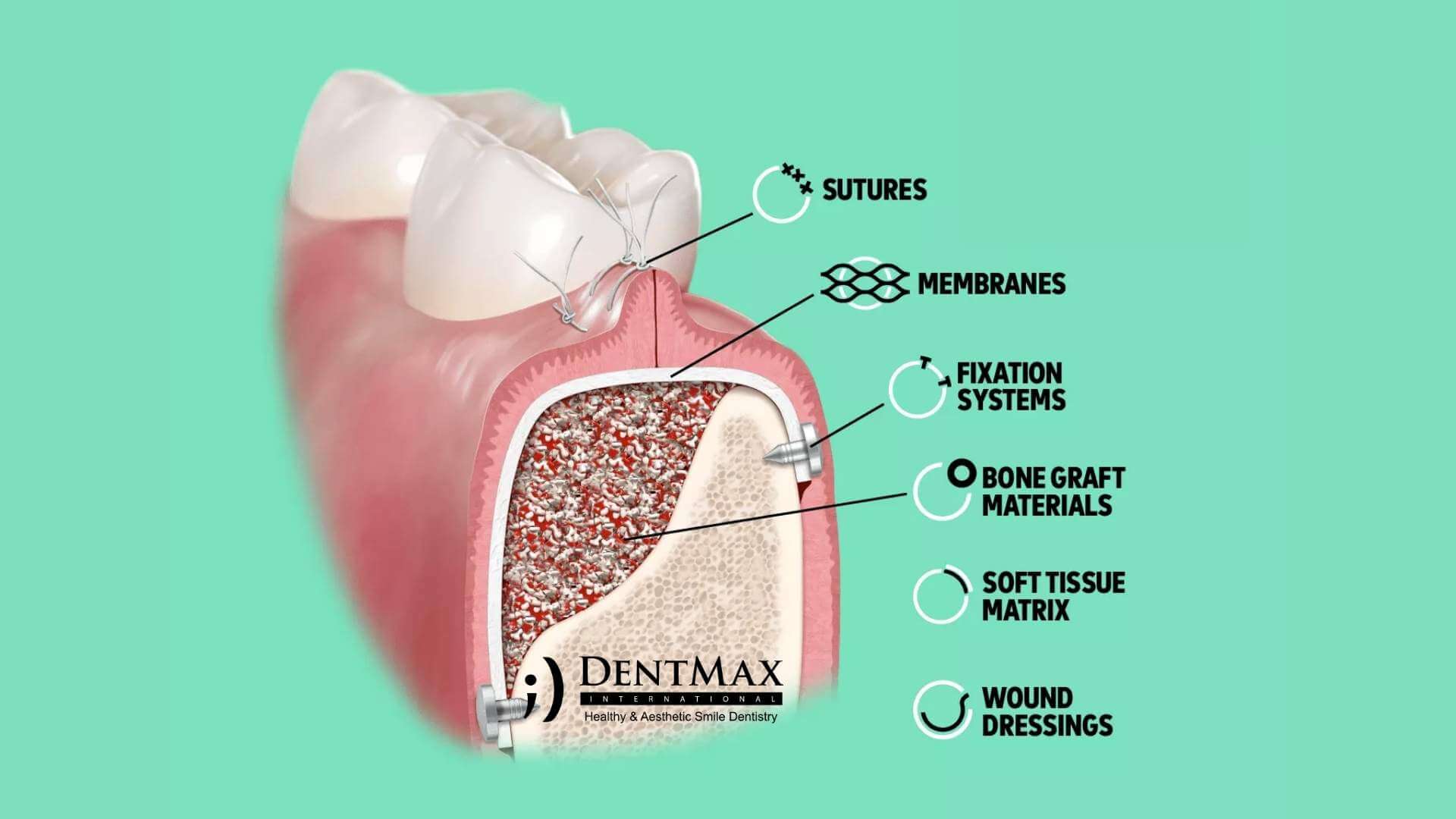 Dentmax Tedaviler