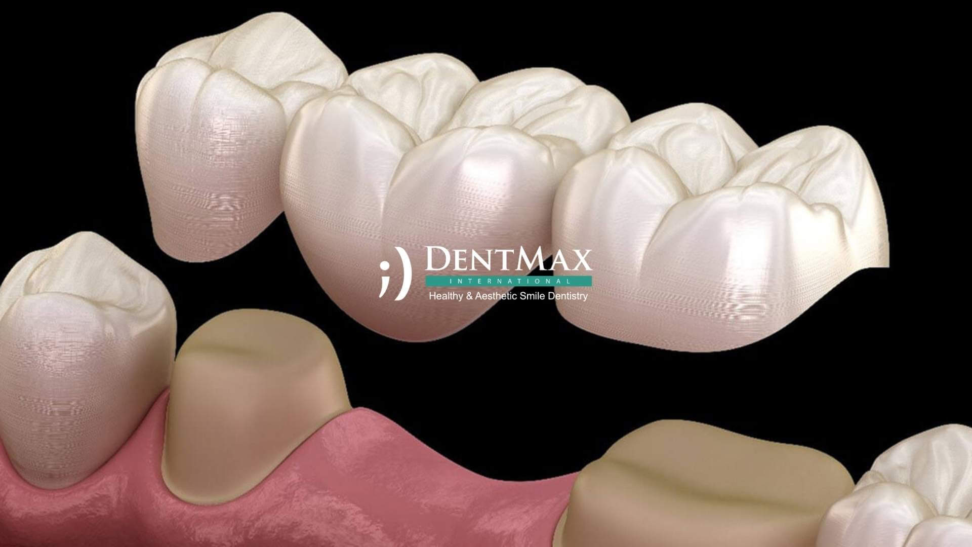 Dentmax
