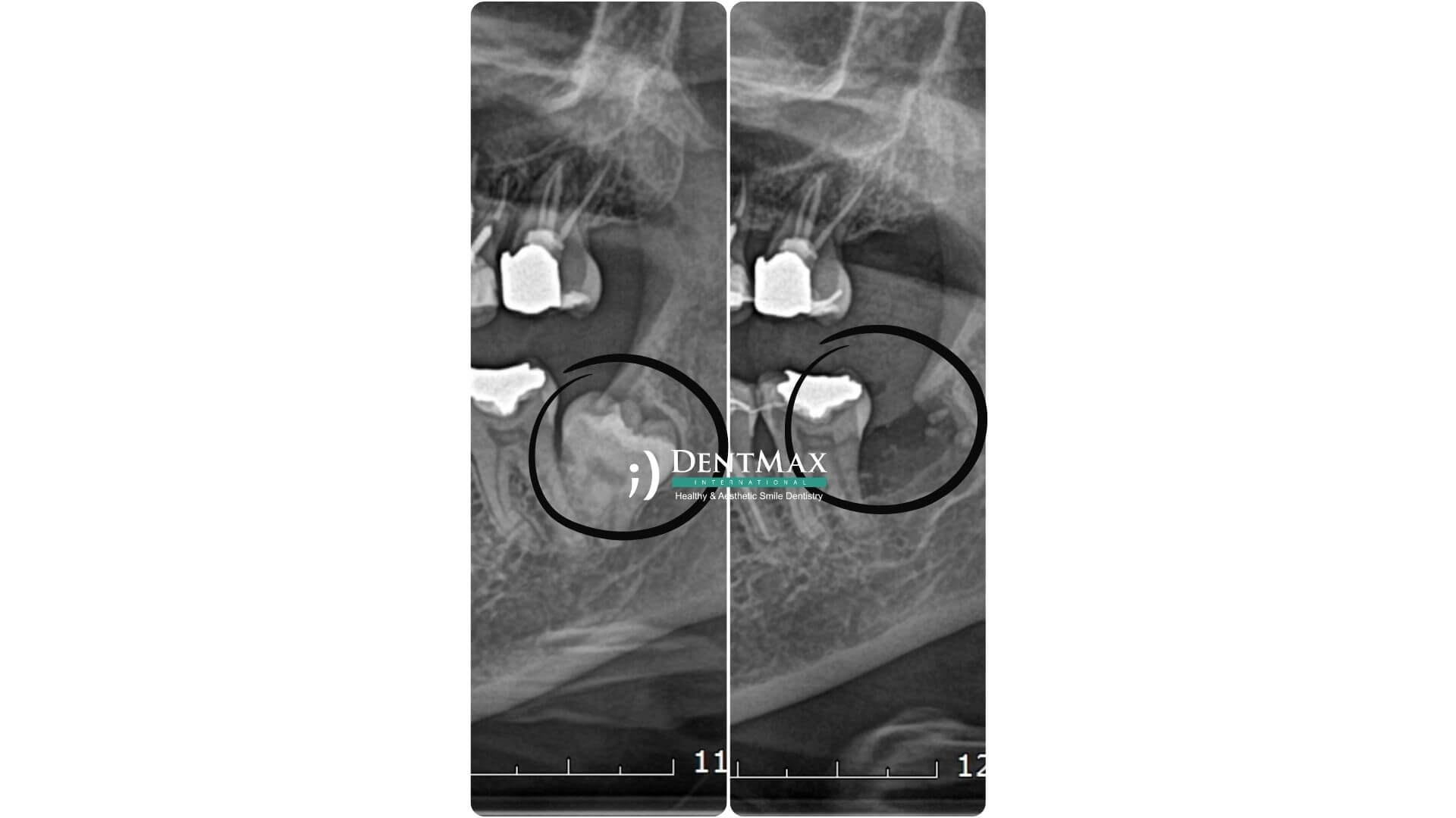 Dentmax Banner
