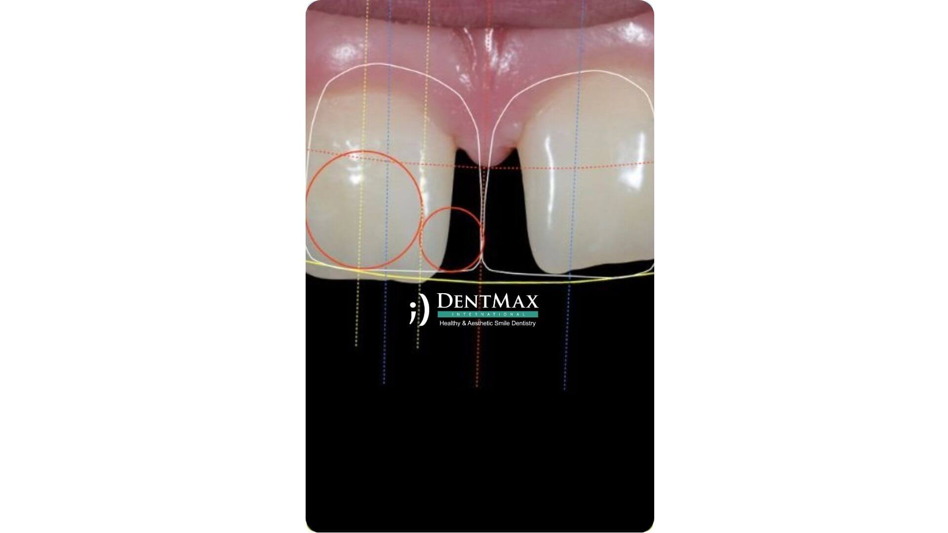 Dentmax Banner