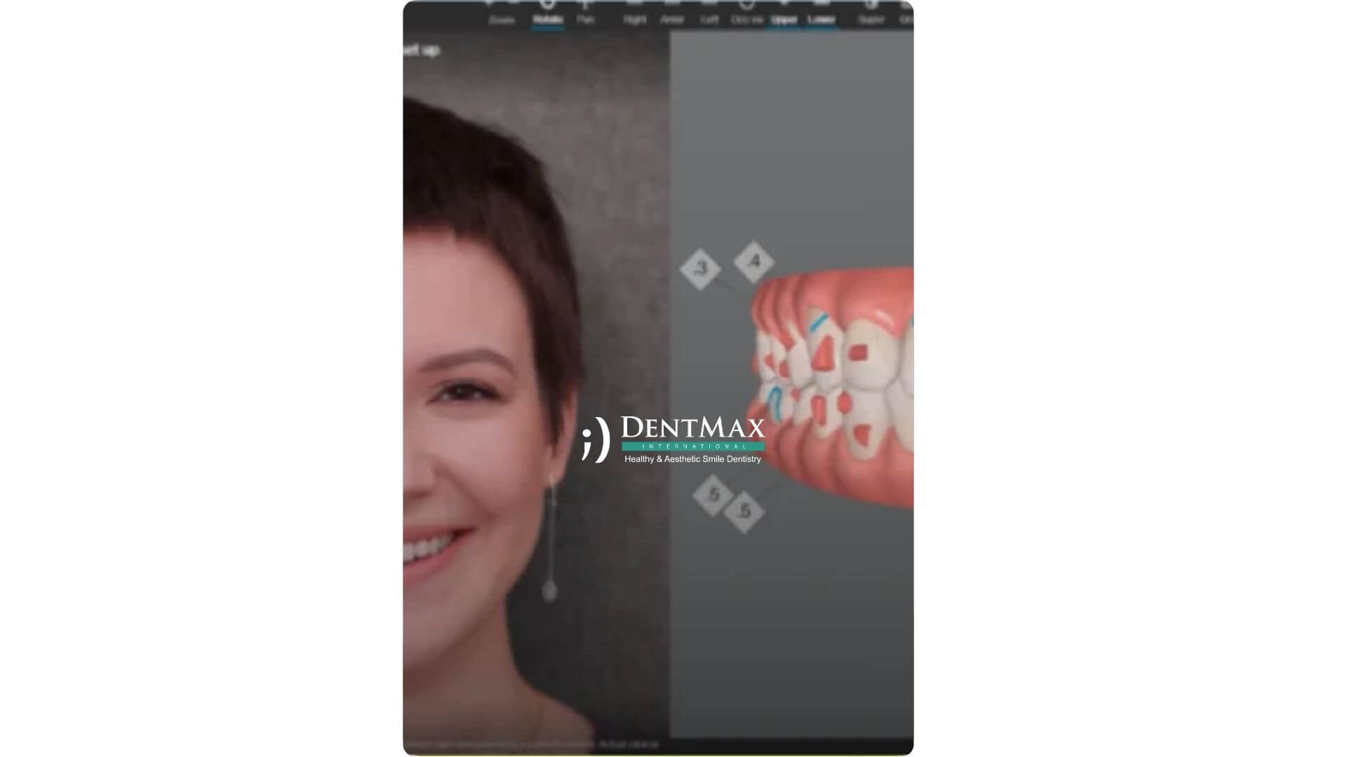Dentmax Banner