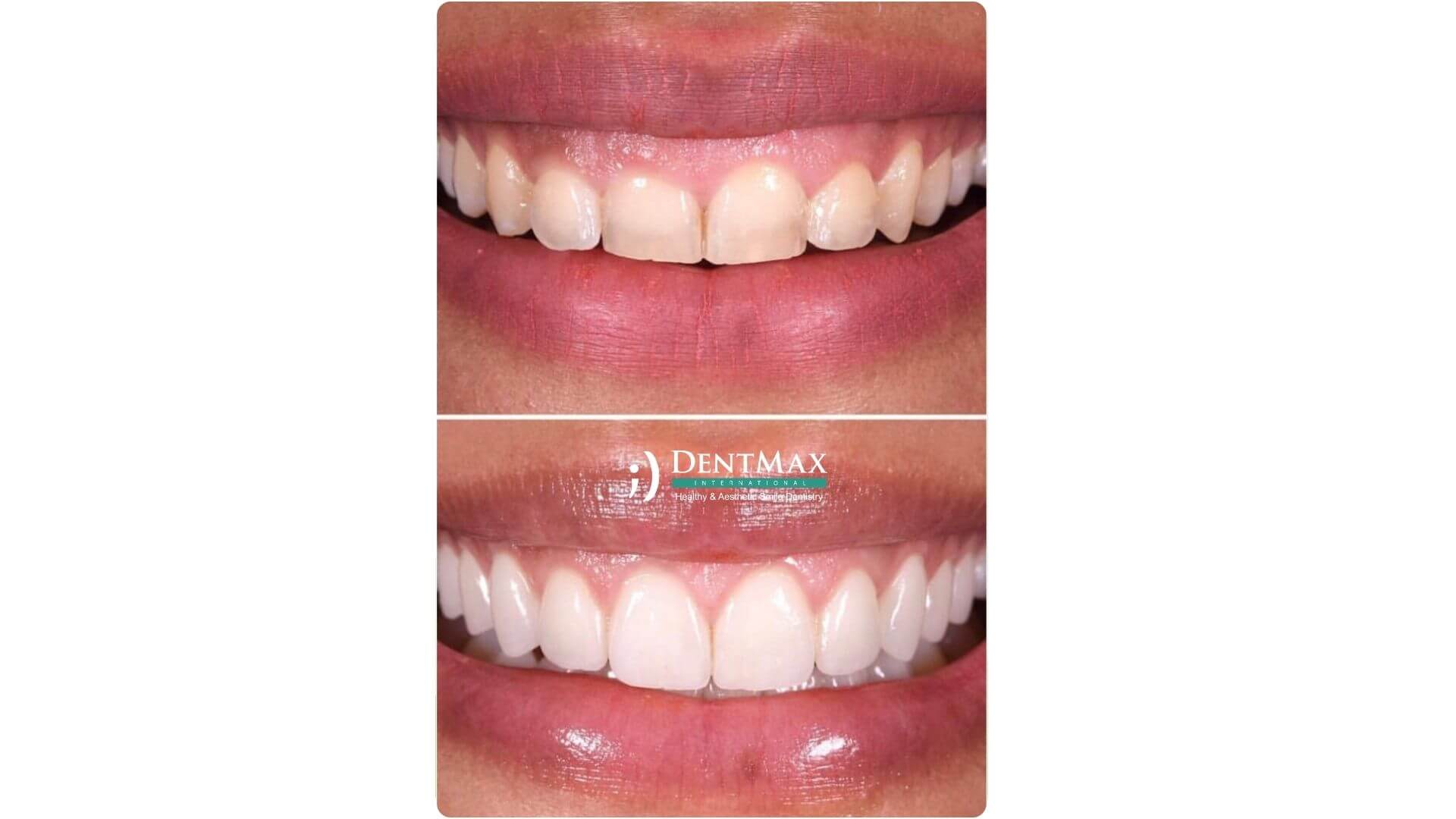 Dentmax Banner