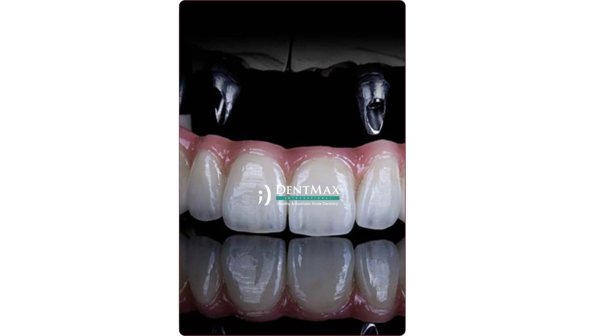 Dentmax Banner
