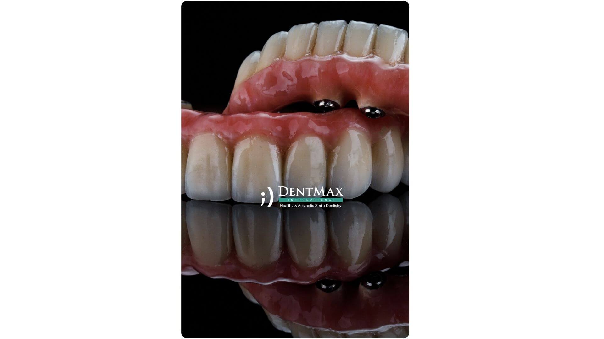 Dentmax Banner