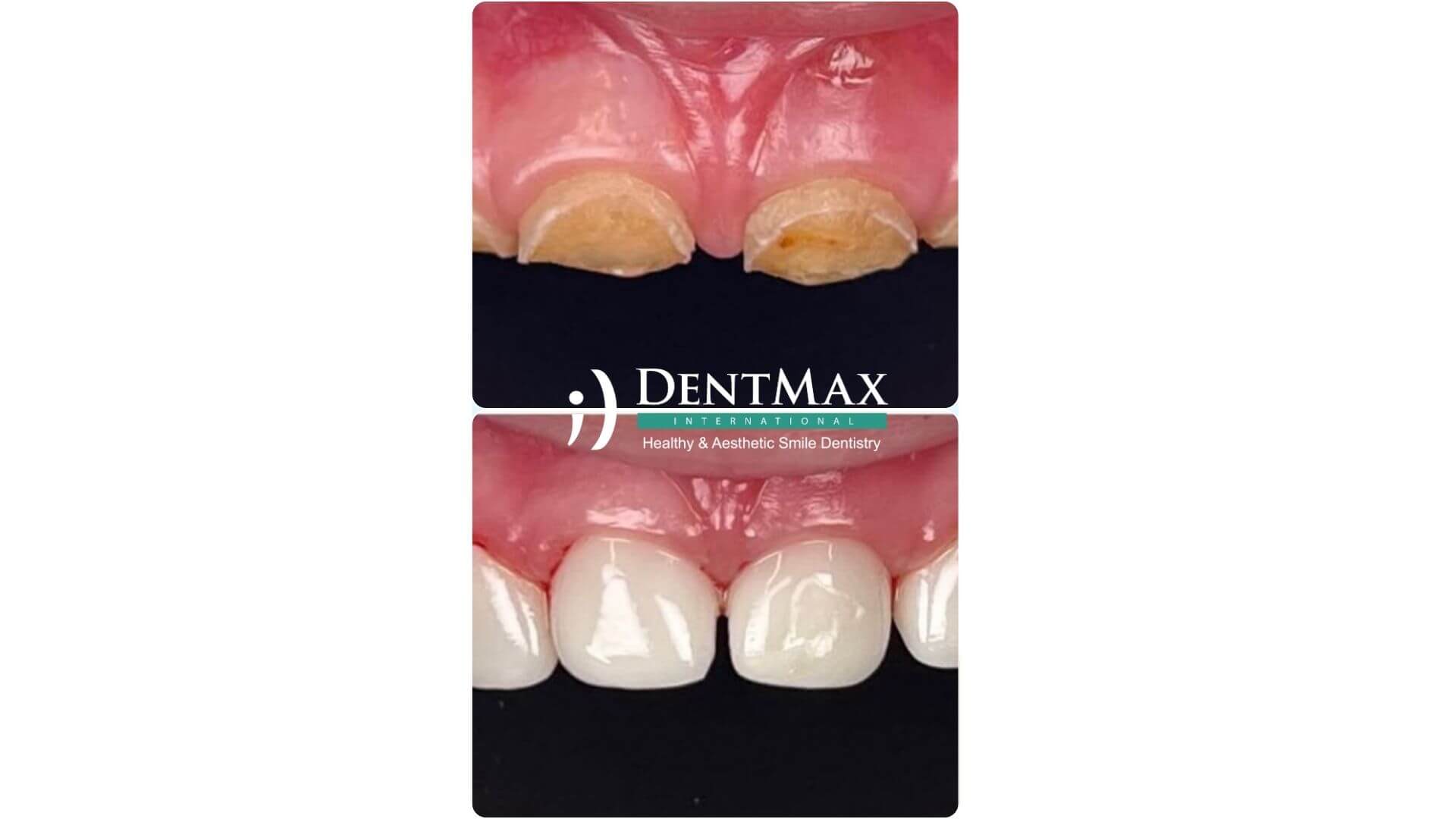 Dentmax Banner