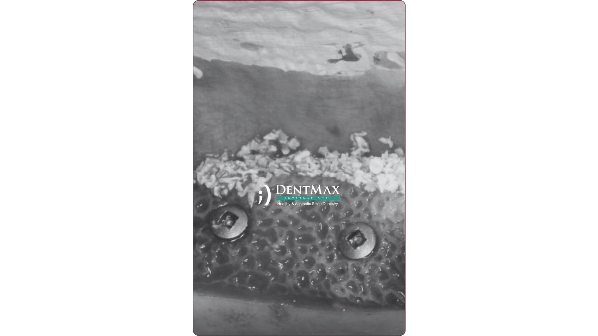 Dentmax Banner