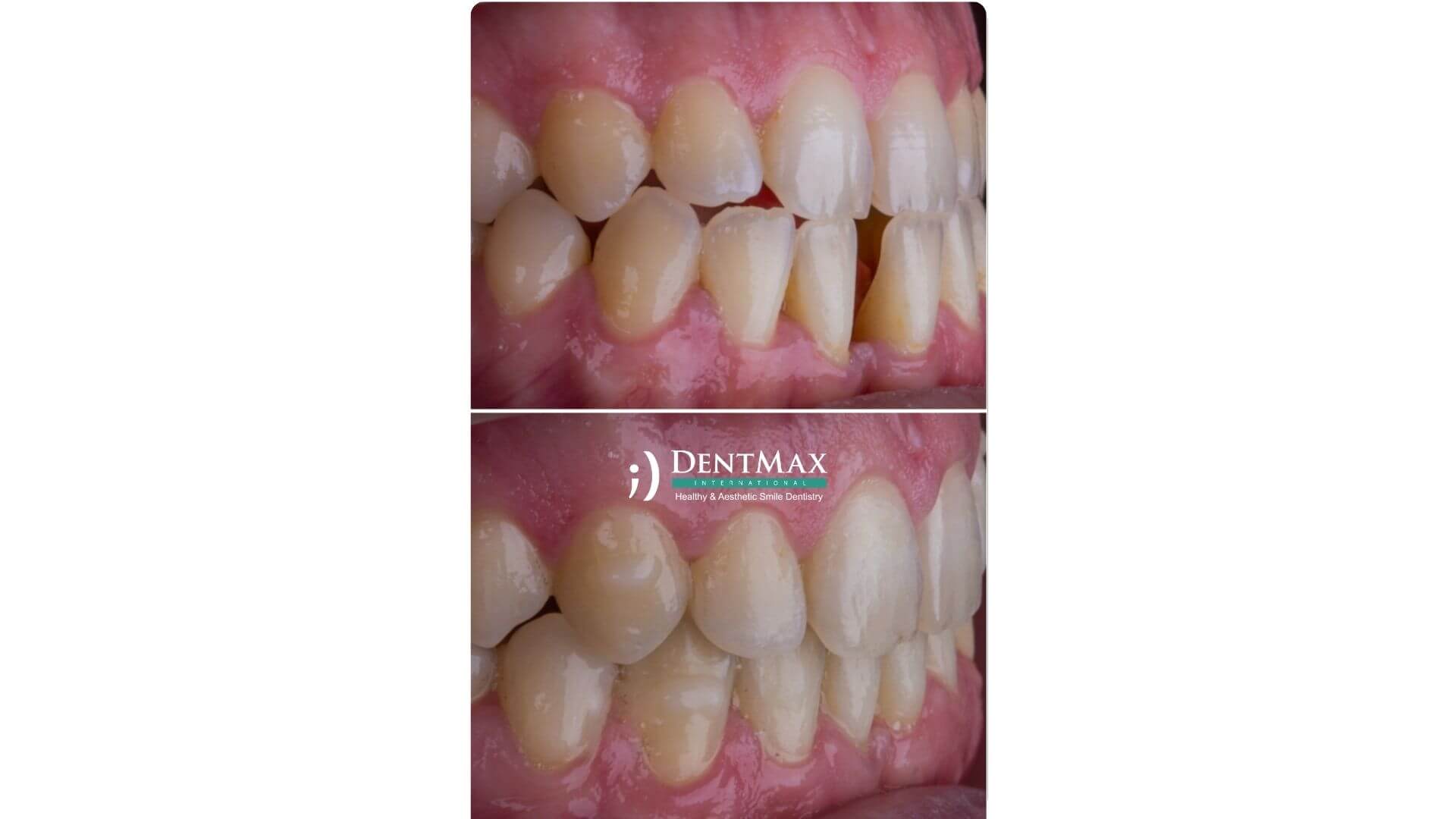Dentmax Banner