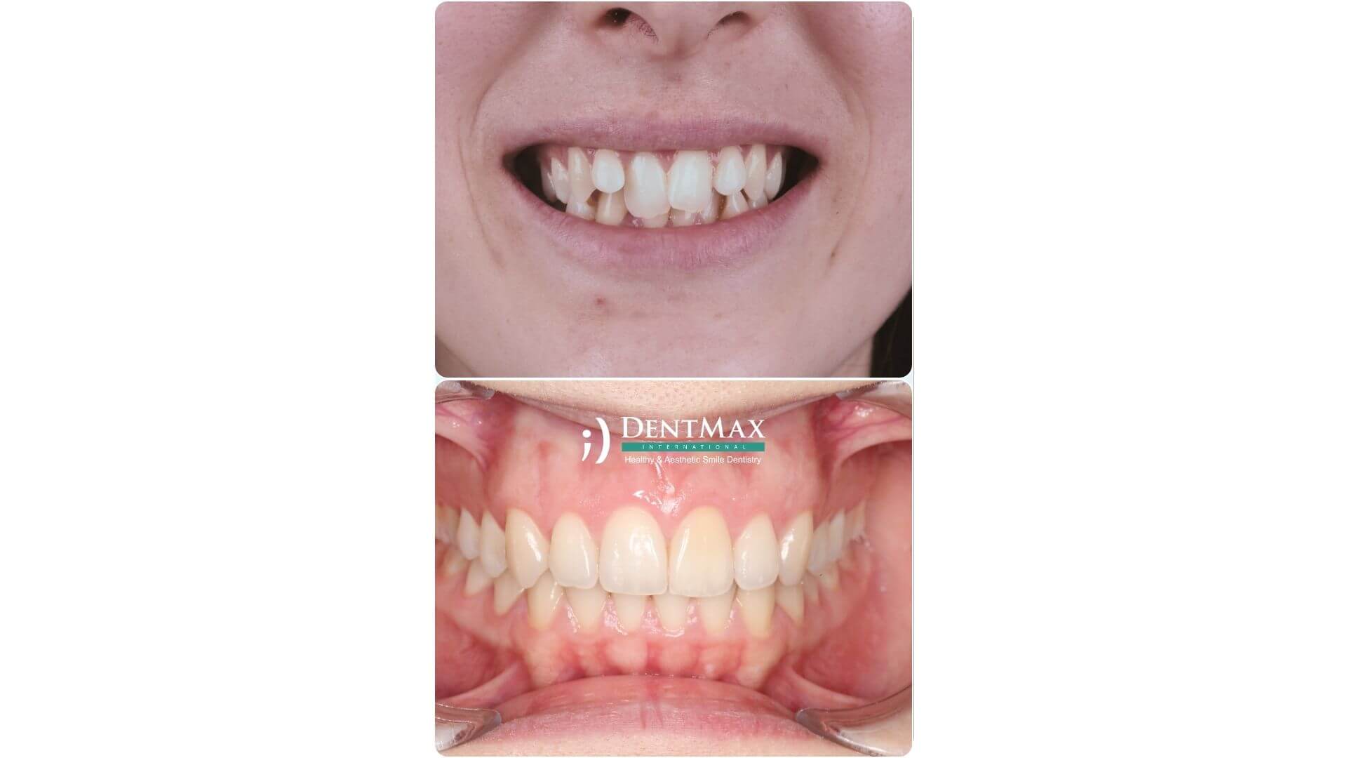 Dentmax Banner