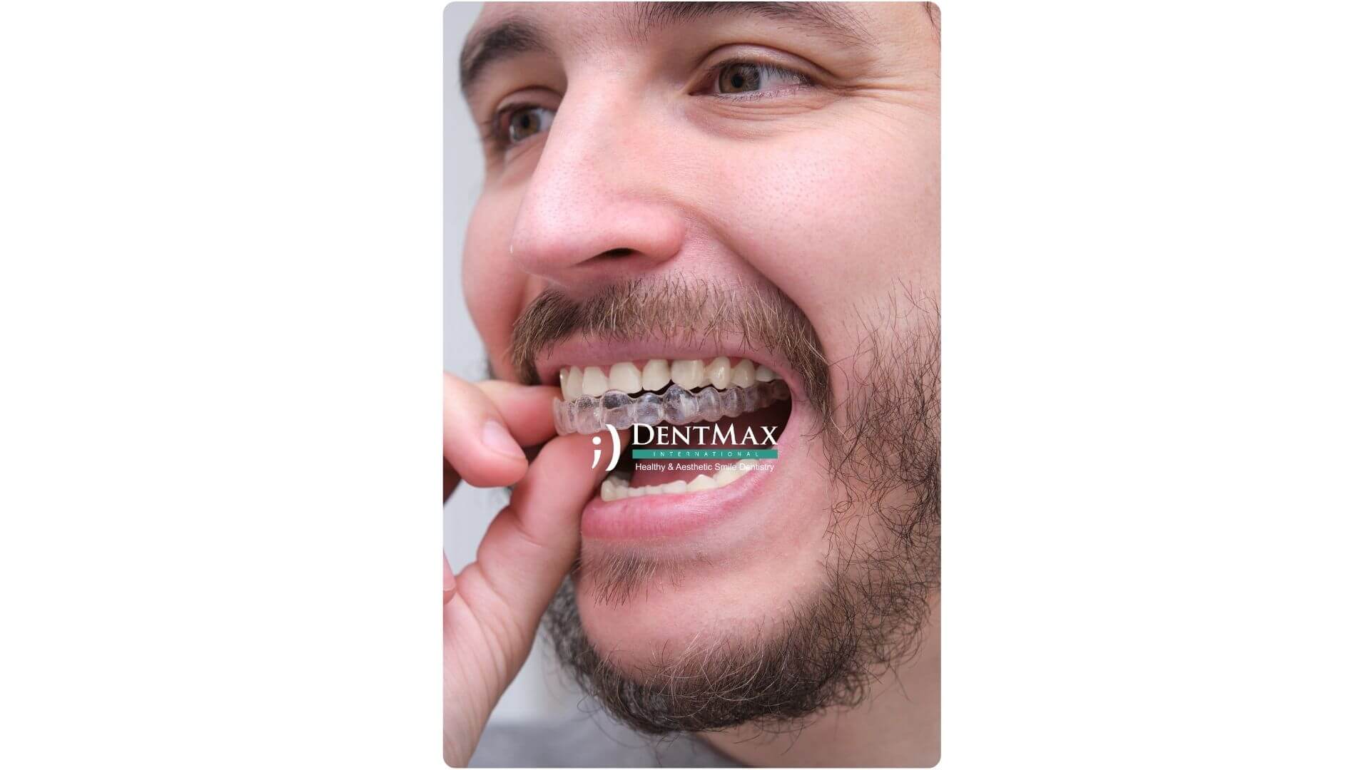 Dentmax Banner