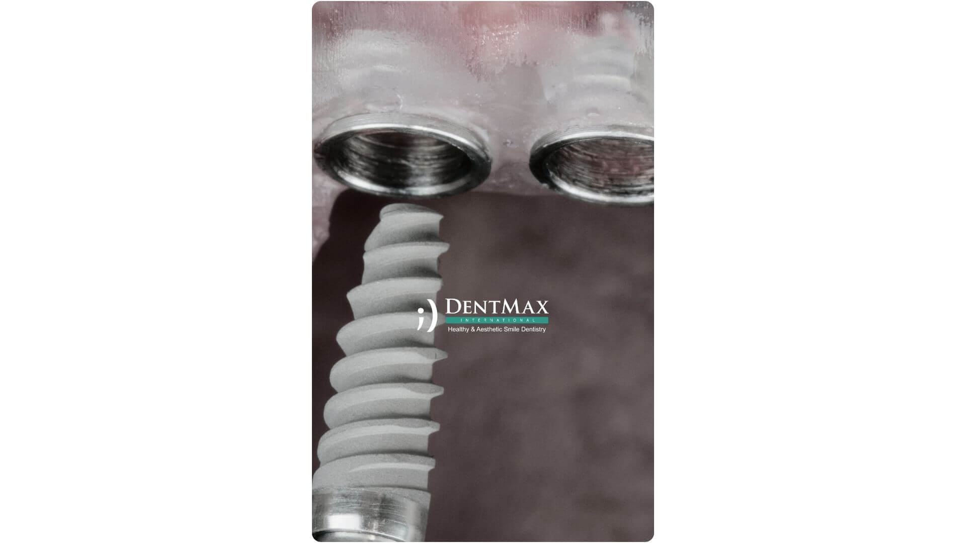 Dentmax Banner