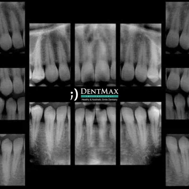 Dentmax Banner