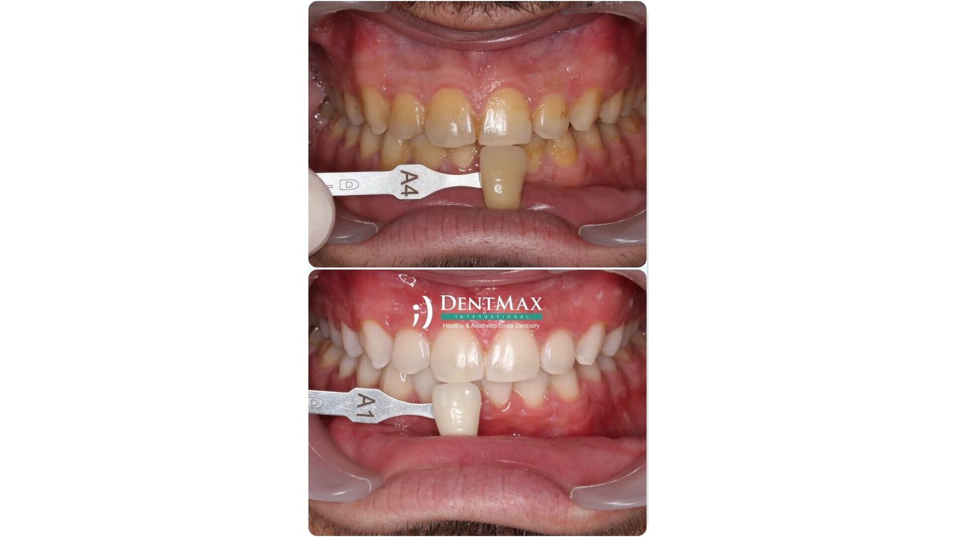 Dentmax Banner