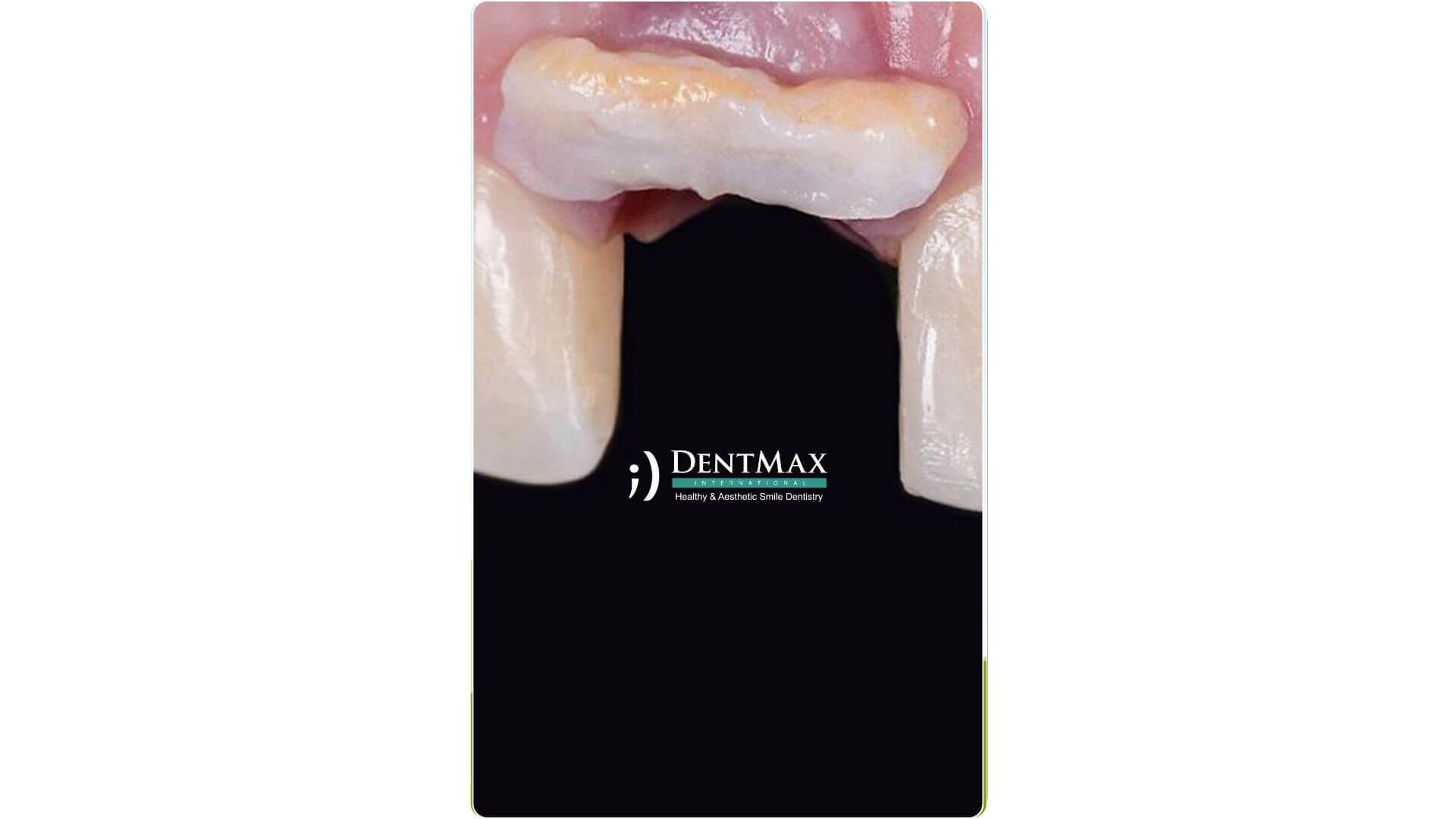 Dentmax Banner