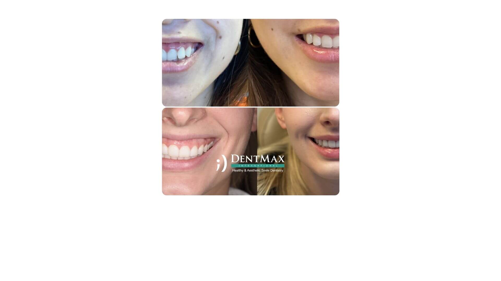 Dentmax Banner