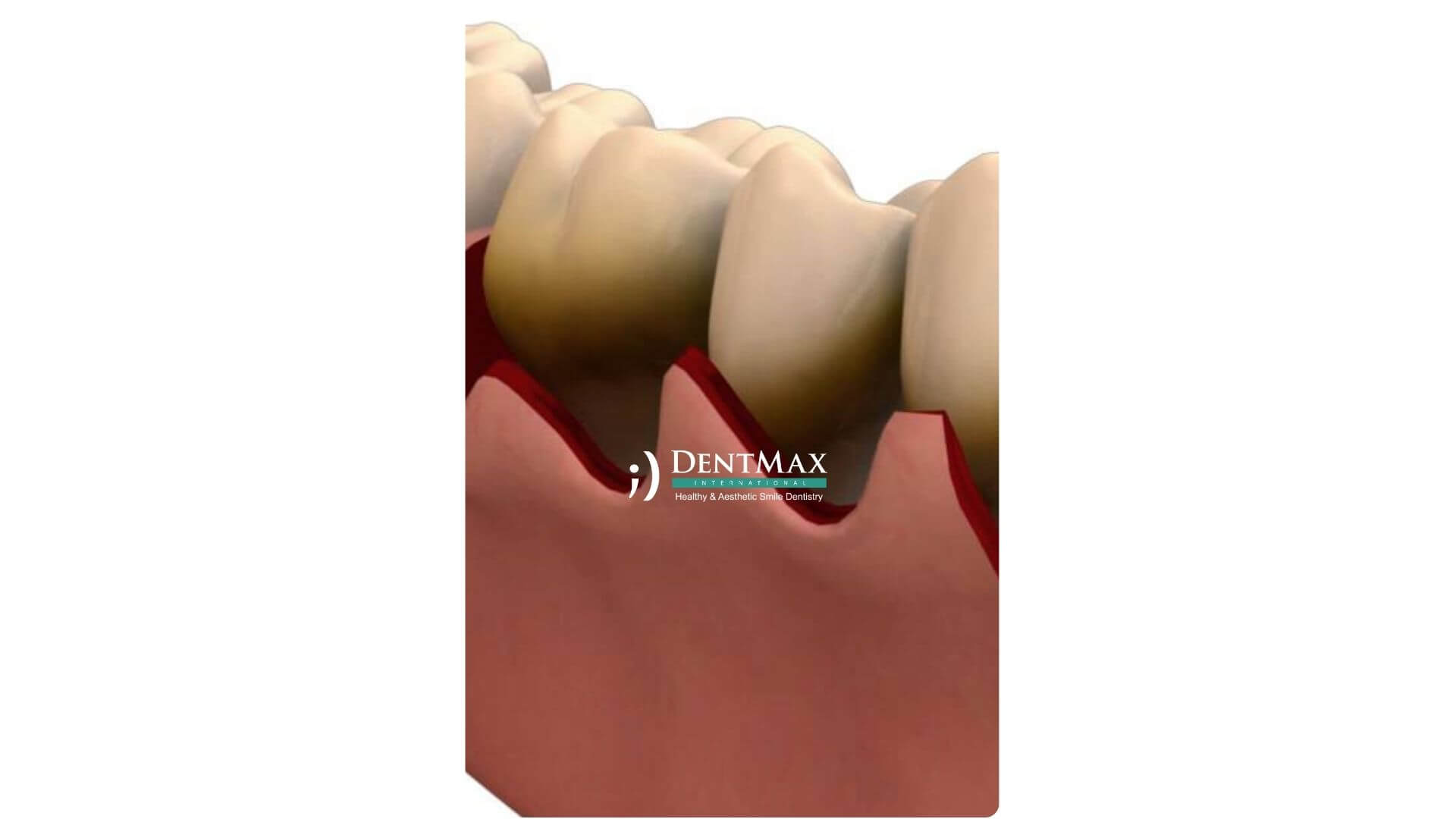 Dentmax Banner