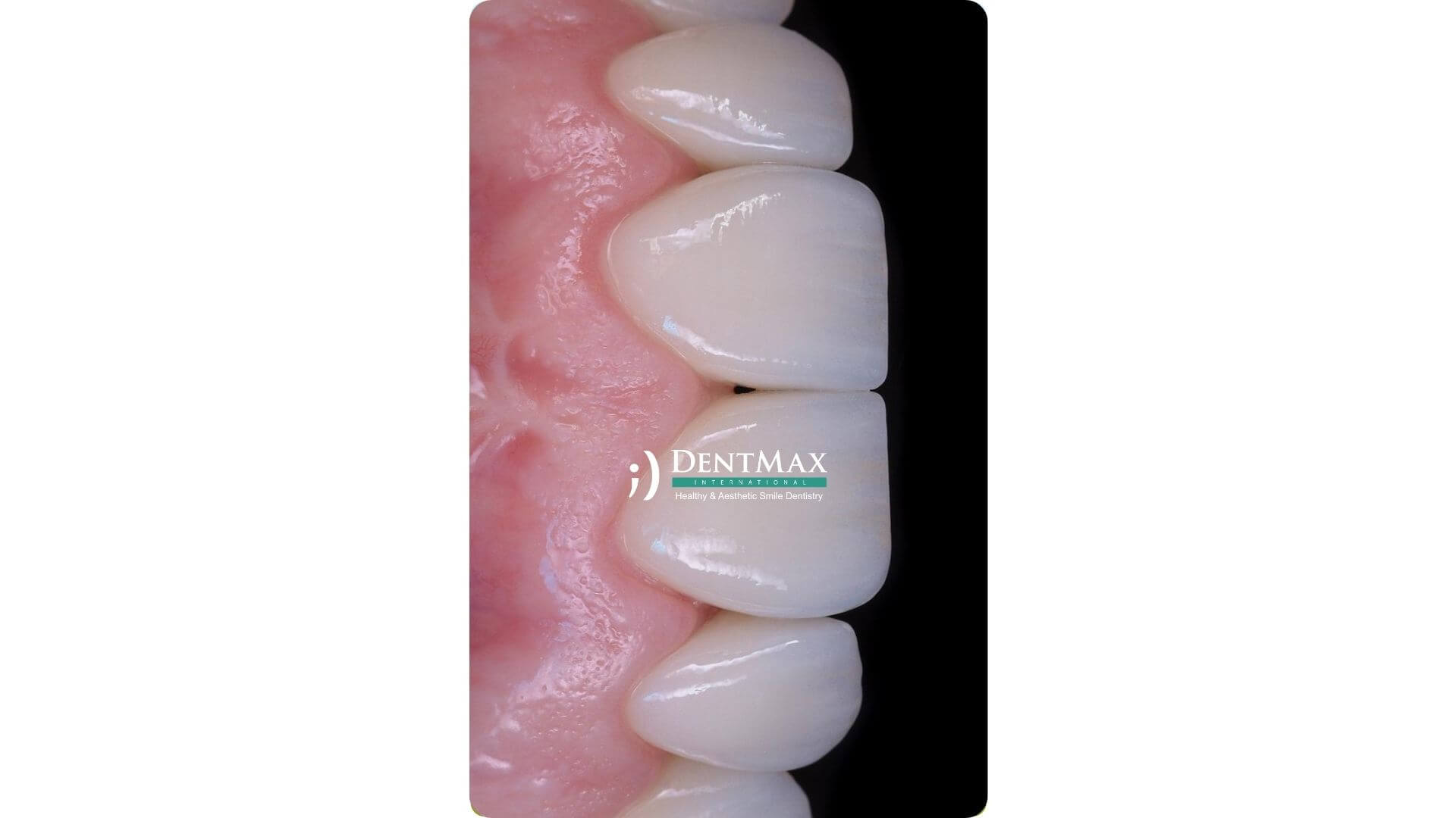 Dentmax Banner