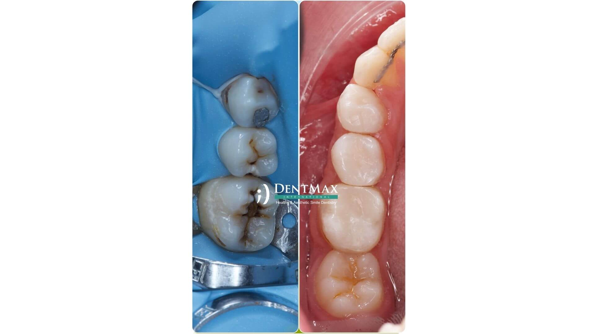 Dentmax Banner