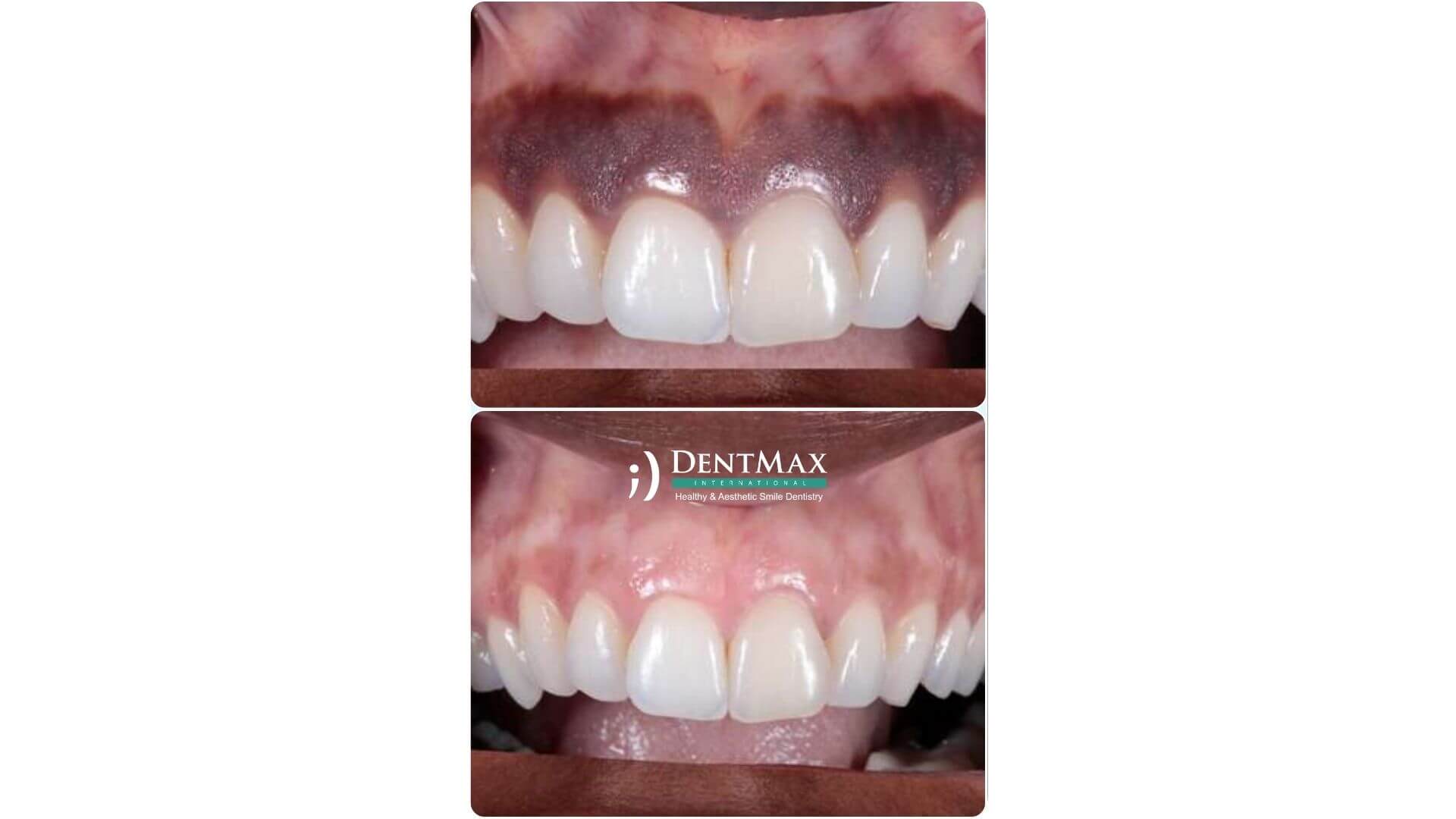 Dentmax Banner
