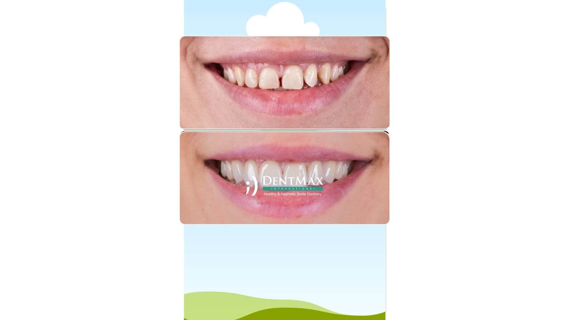 Dentmax Banner