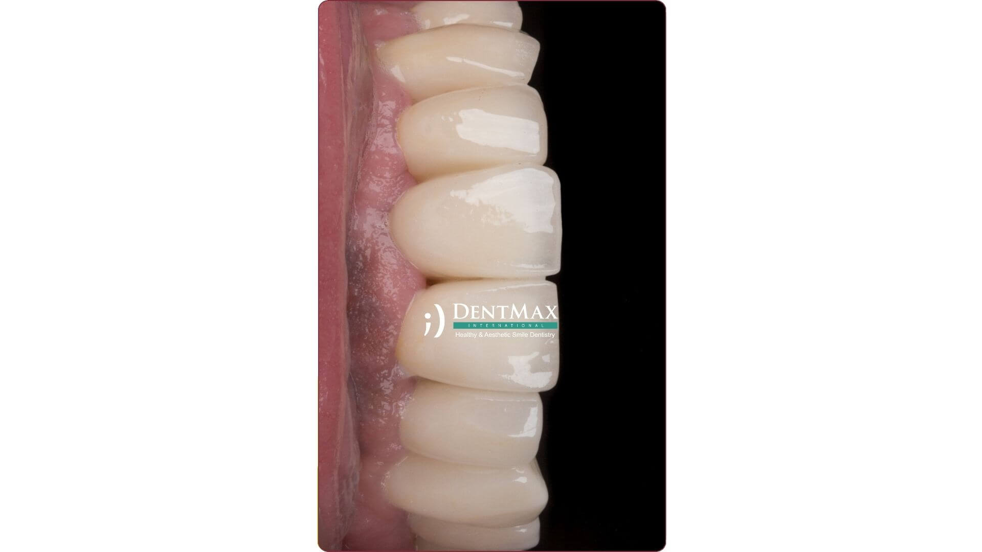 Dentmax Banner