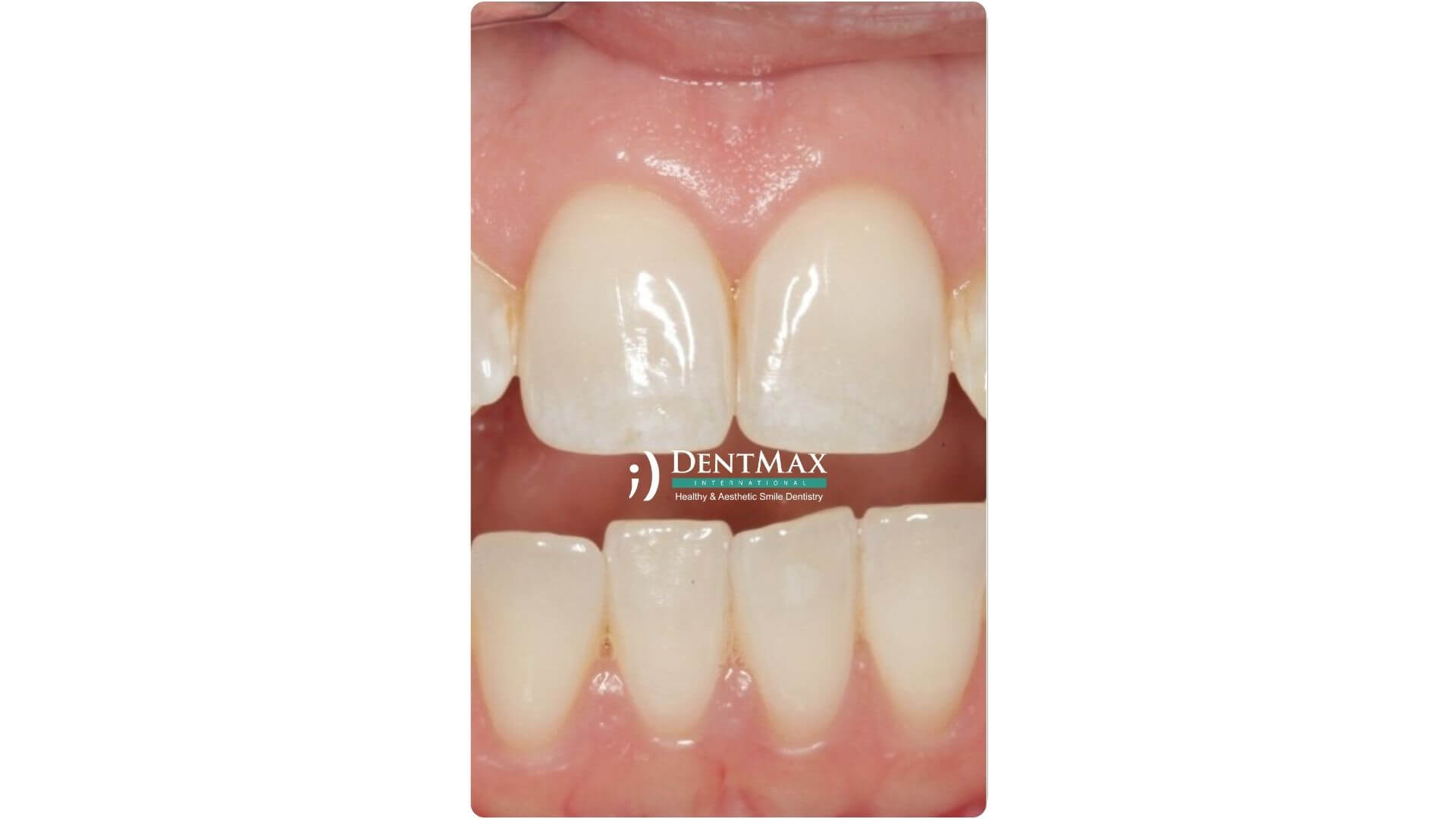 Dentmax Banner