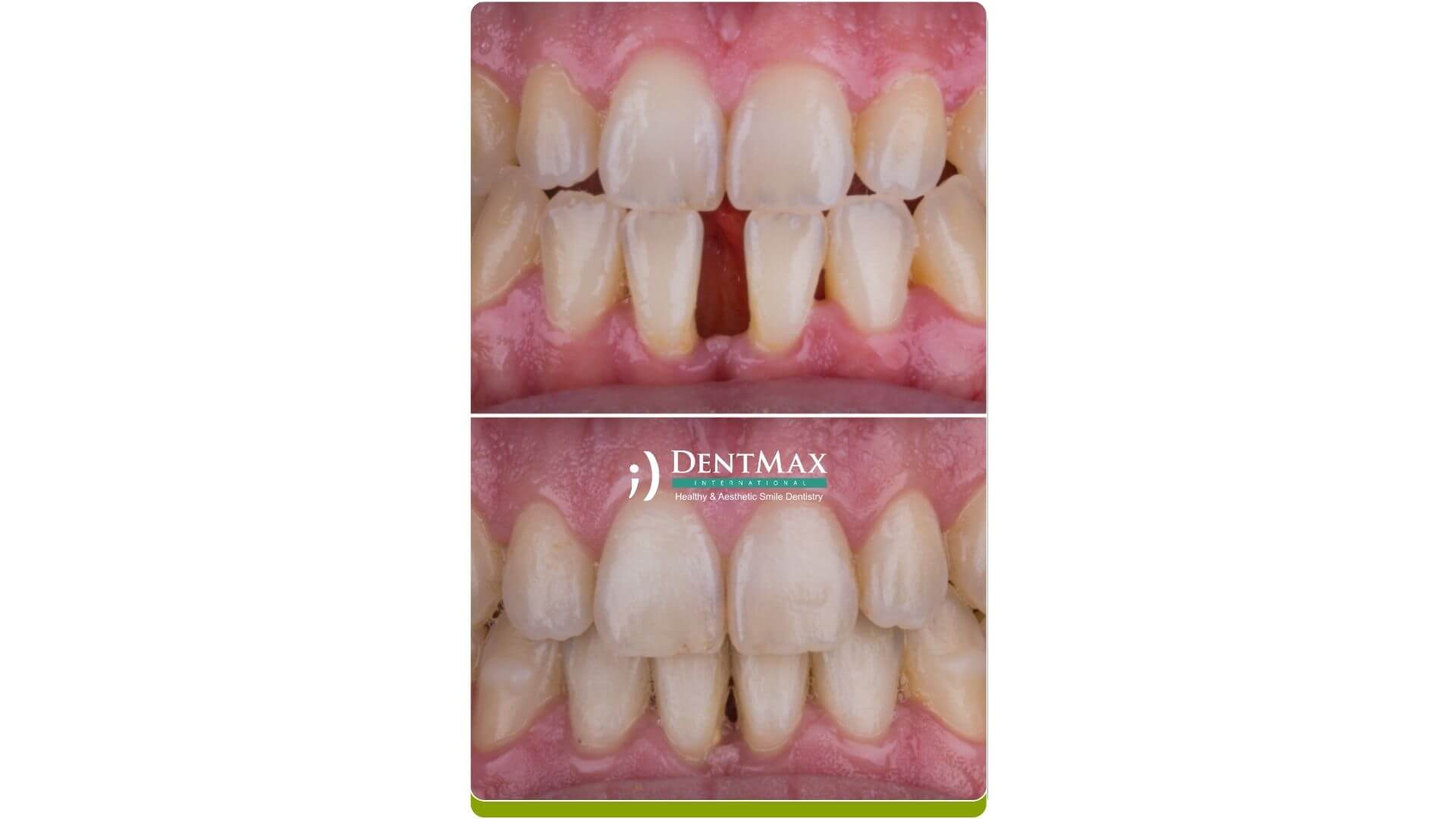 Dentmax Banner