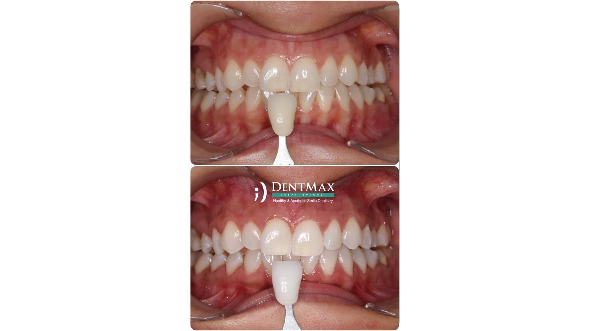 Dentmax Banner