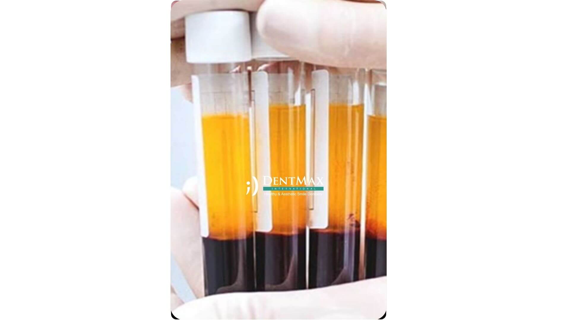 Dentmax Banner