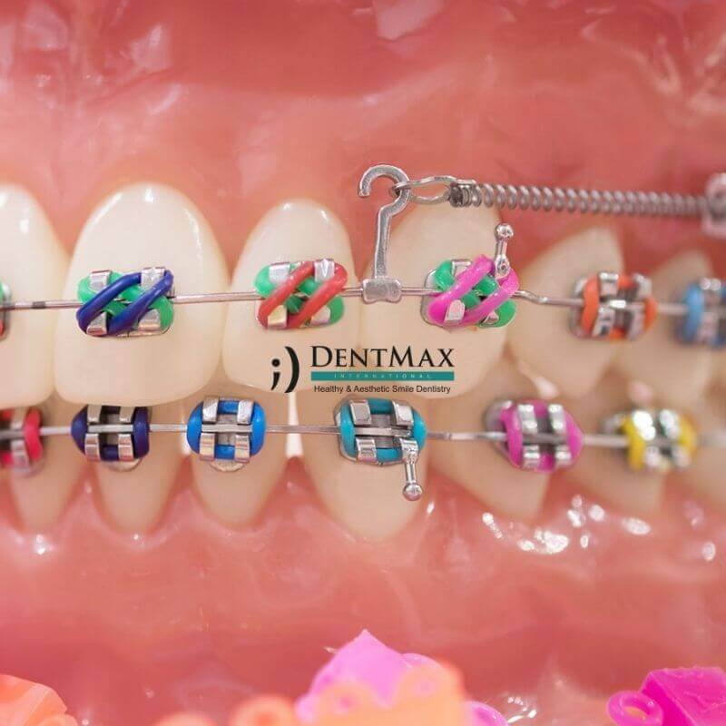 Dentmax Banner